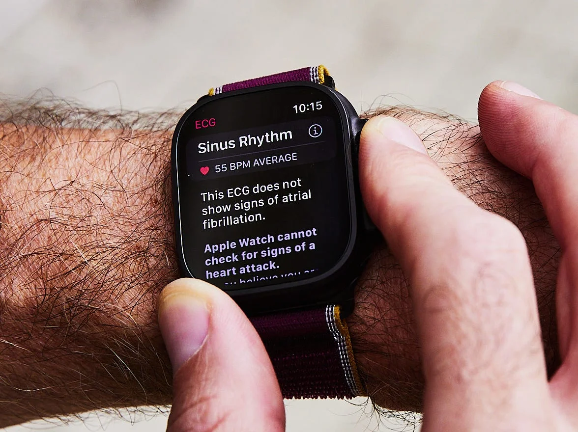 Person checking ECG readings on a smartwatch displaying sinus rhythm and heart rate information on a wrist.